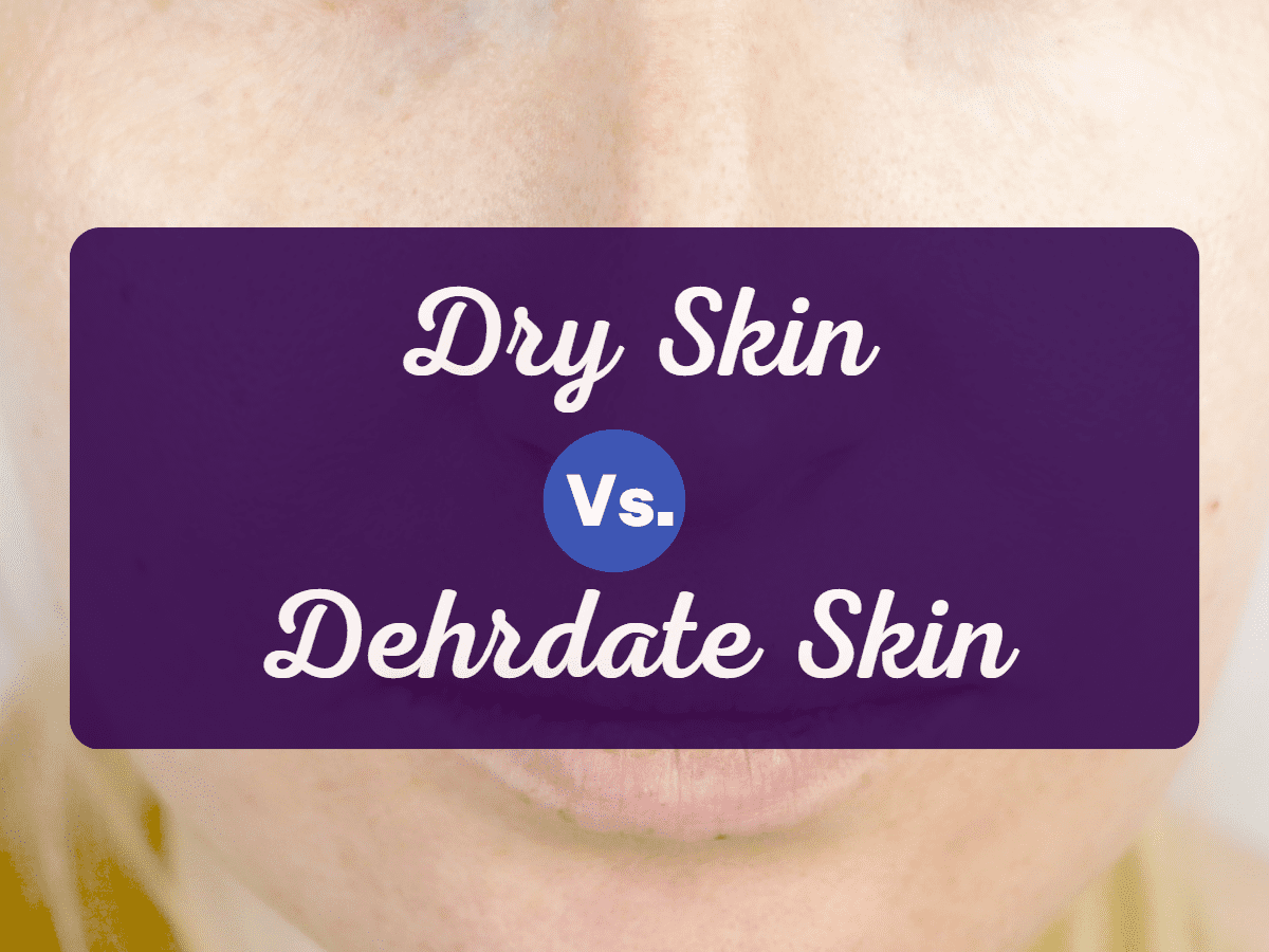 Dry Skin Vs. Dehydrated Skin